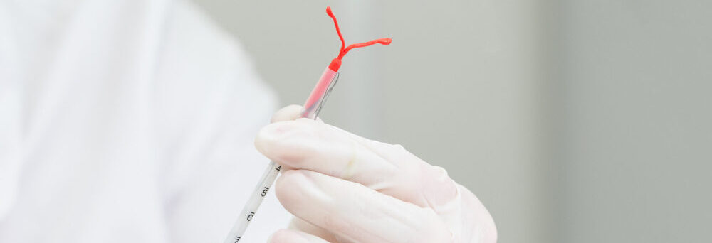 Profissional da saúde segurando um dispositivo intrauterino (DIU)