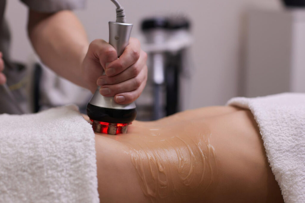 Pessoa recebendo tratamento estético de radiofrequência na região abdominal, com aplicação de gel condutor e uso de aparelho com luz vermelha