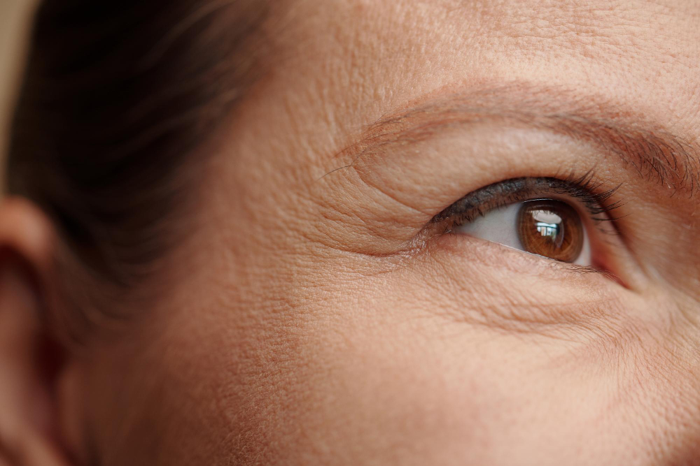 Close-up da região dos olhos de uma pessoa, destacando rugas finas e linhas de expressão ao redor dos olhos.